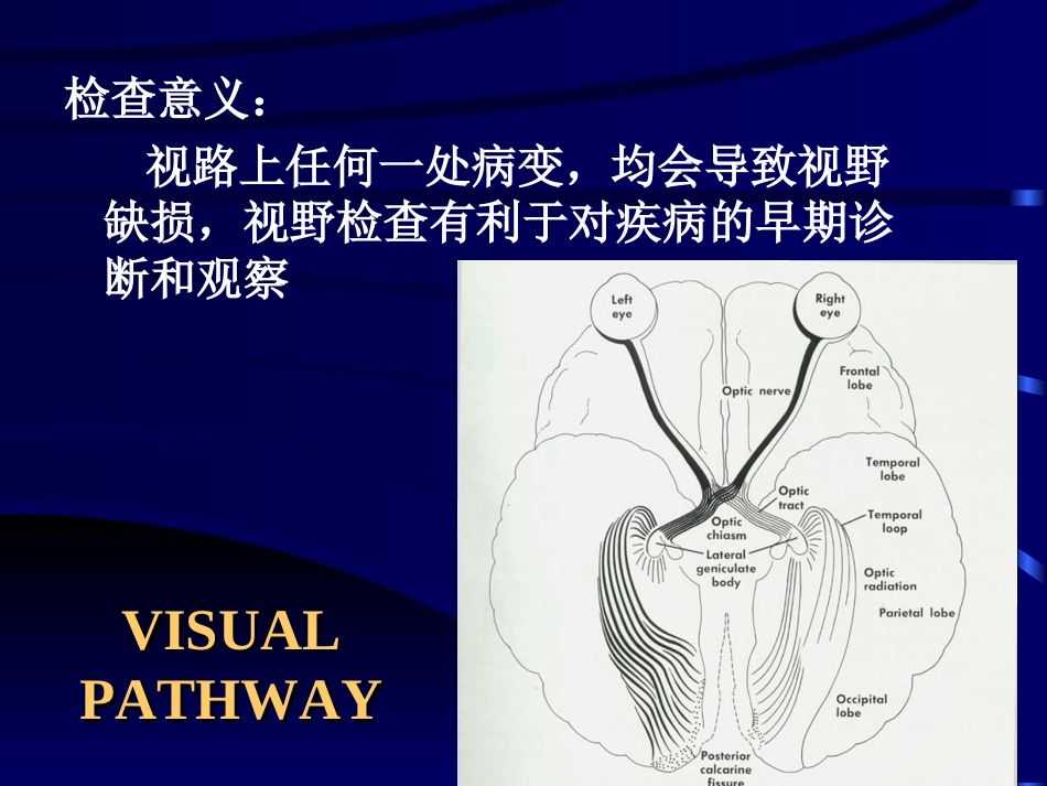 视野计及其检查、判读方法_第3页