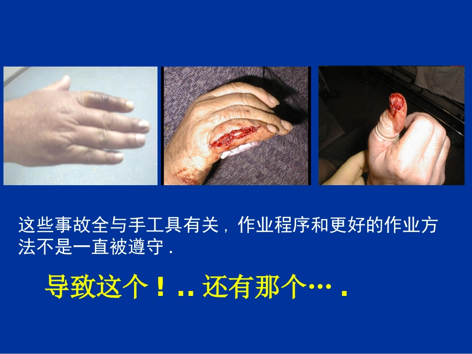 防止手工具伤害_第2页