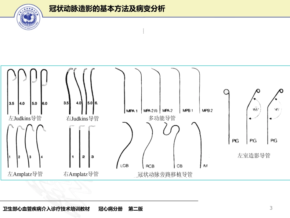 冠状动脉造影基本方法及病变分析-文档资料_第3页