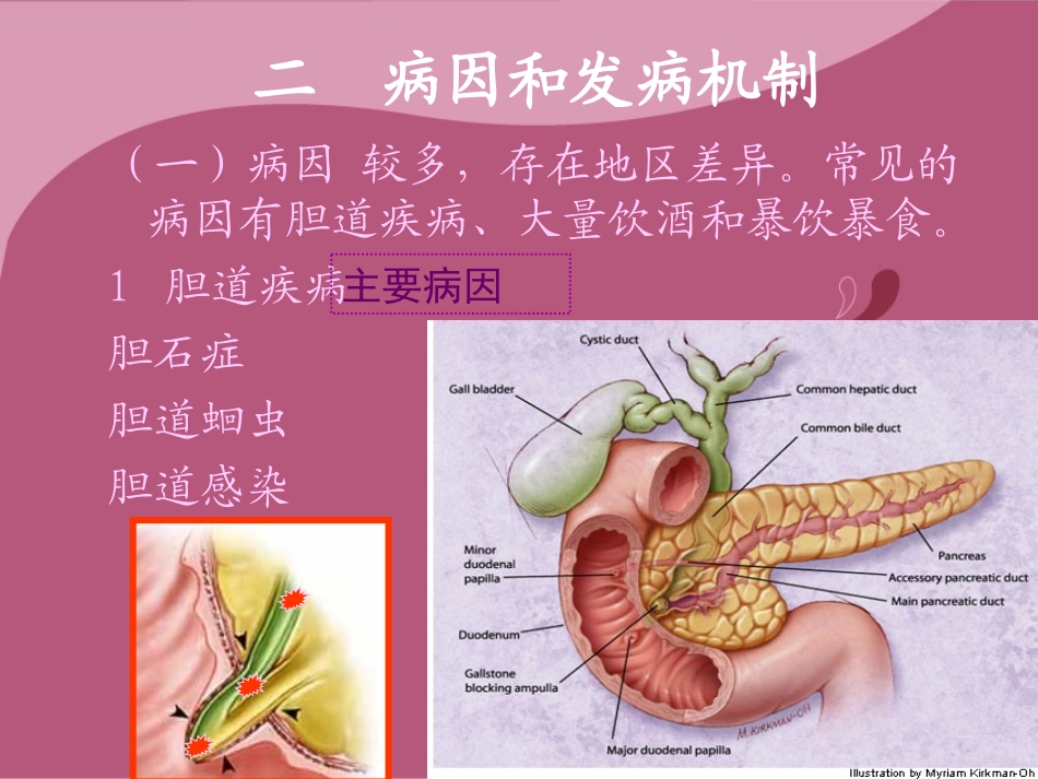 急性胰腺炎讲课_第3页
