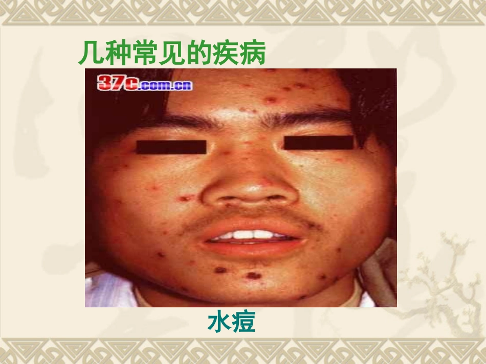 传染病及其预防_第3页