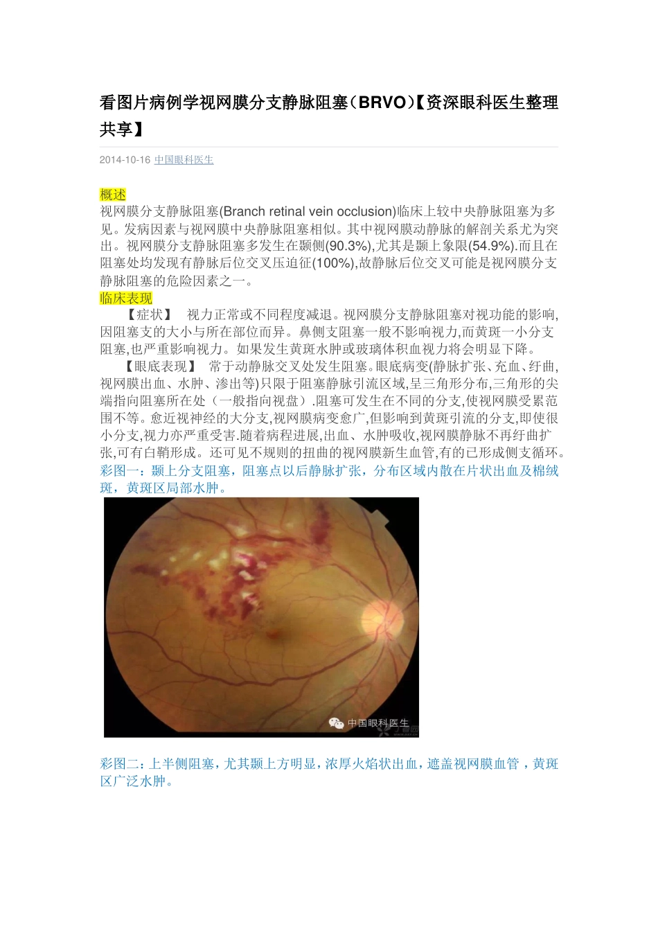 看图片病例学视网膜分支静脉阻塞_第1页