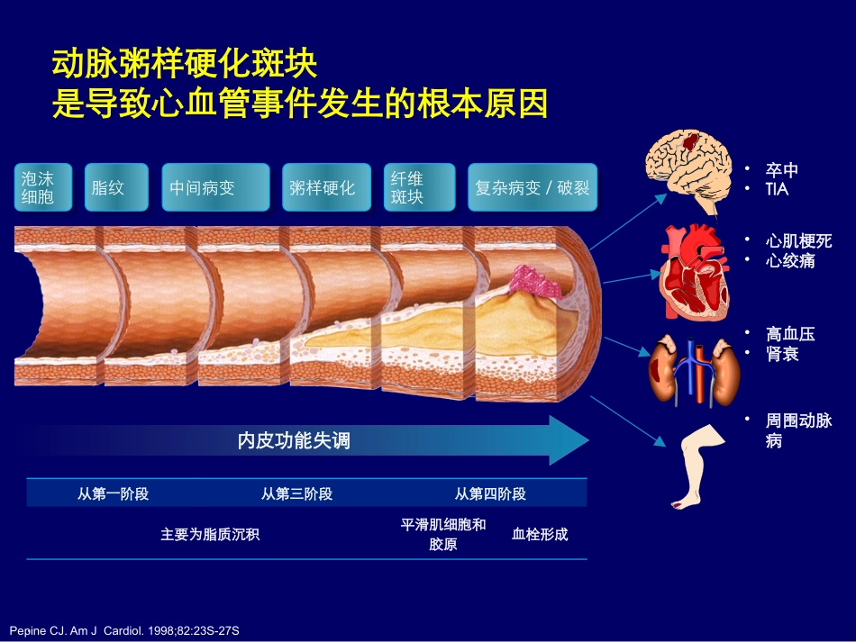 糖尿病与动脉粥样硬化_第3页