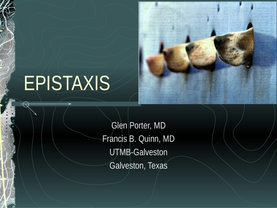 鼻出血(英文)_第1页