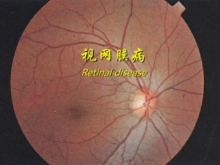 视网膜病图谱