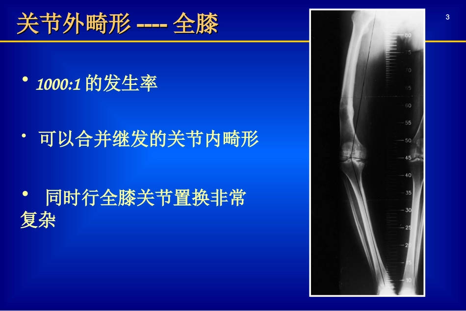 关节外畸形全膝_第3页