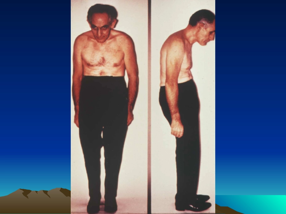 强直性脊柱炎的诊疗经验_第3页