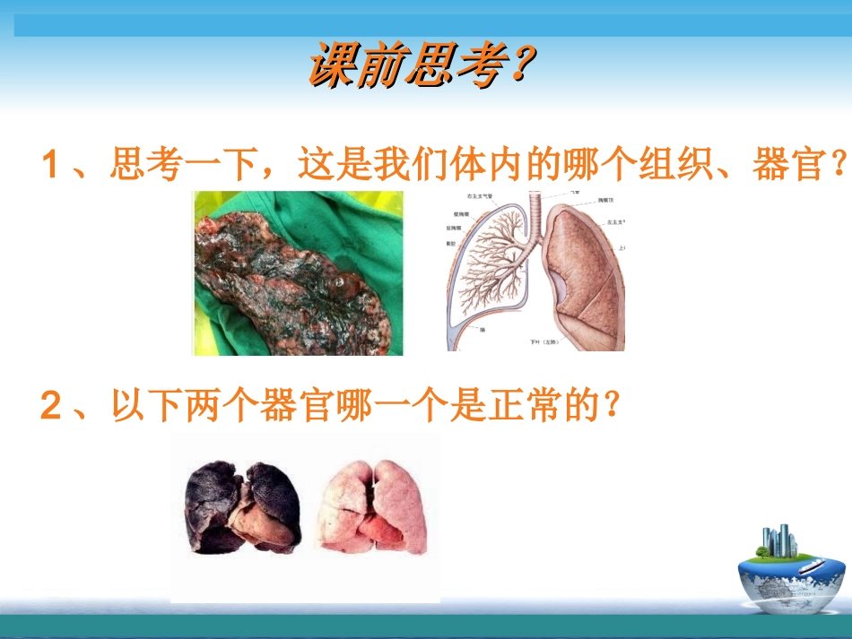 省优课!---【肺癌】----刘宏佳_第2页