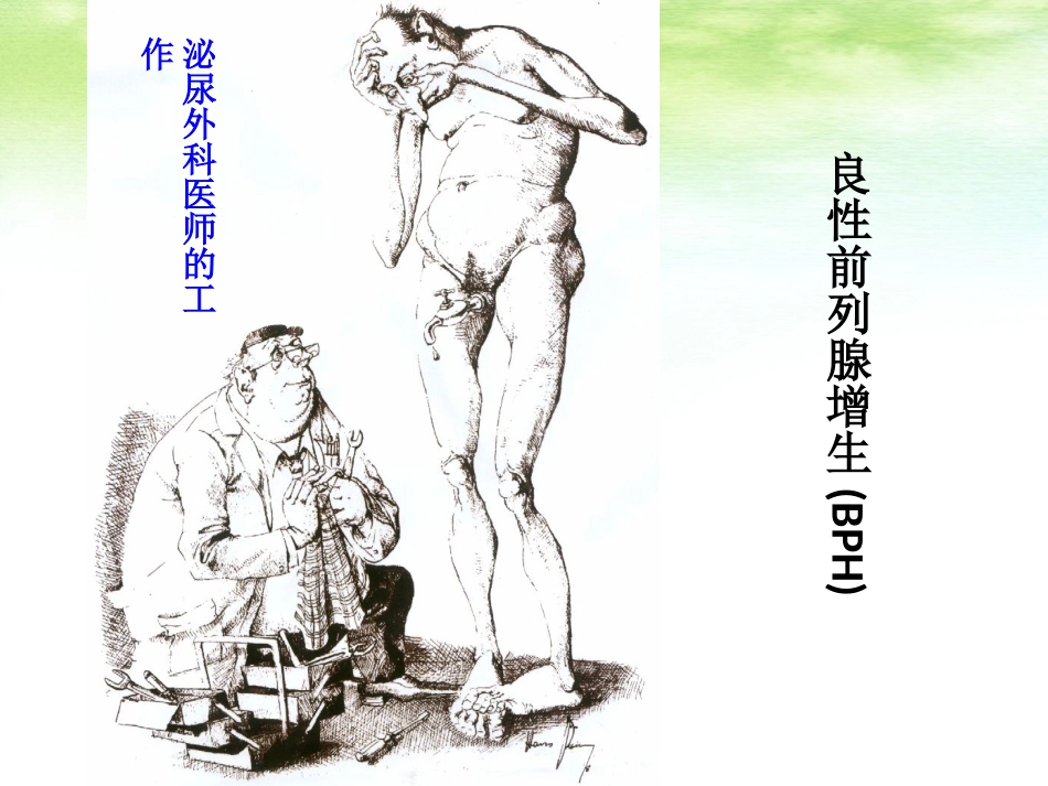 前列腺增生郭荧_第2页