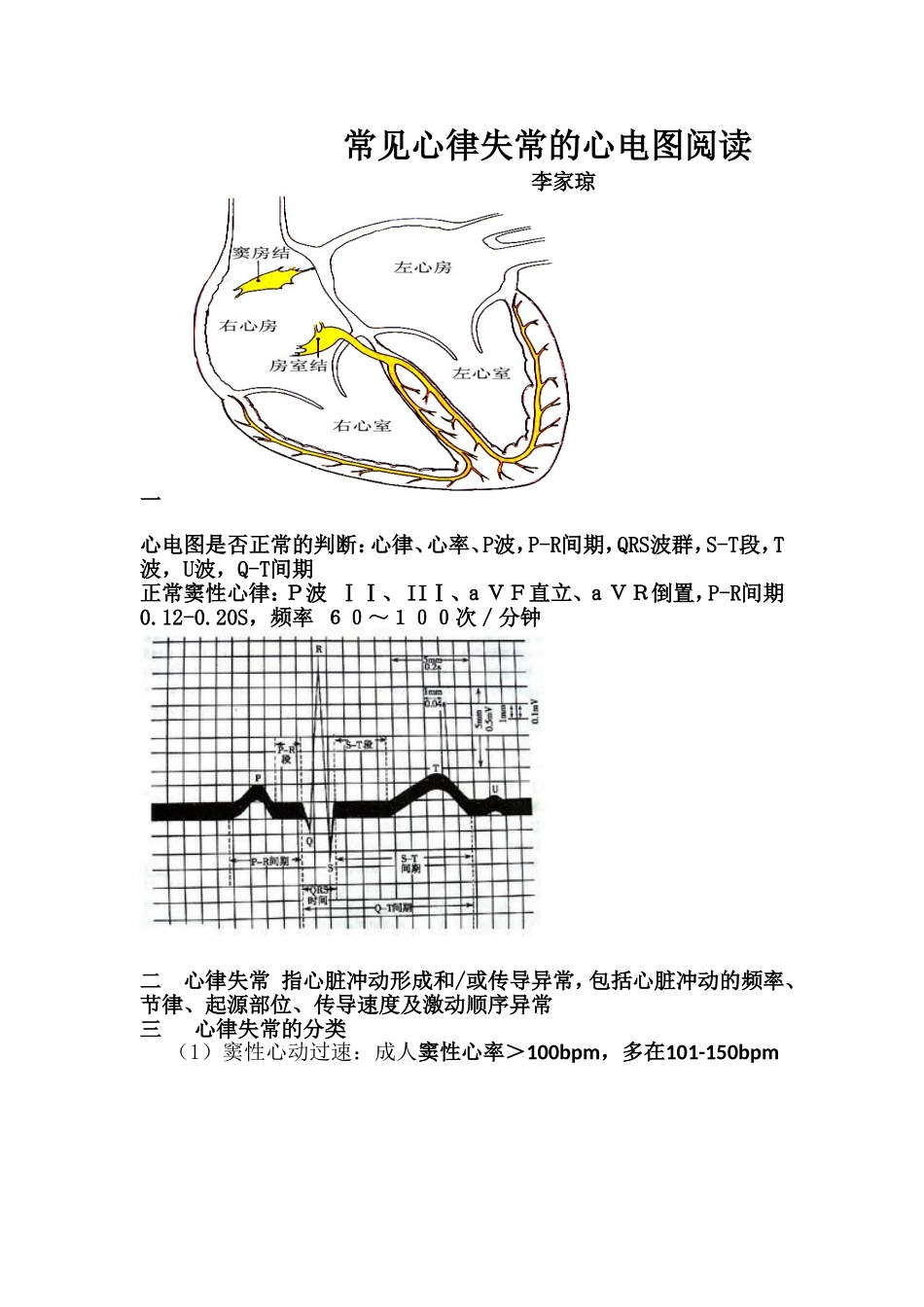 常见心律失常的心电图阅读_第1页