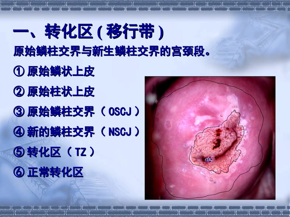宫颈病变几个重要概念及问题思考_第3页