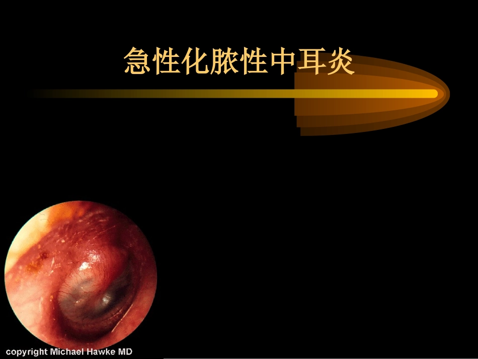 急性中耳炎的应急处理方法_第1页