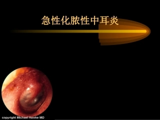 急性中耳炎的应急处理方法