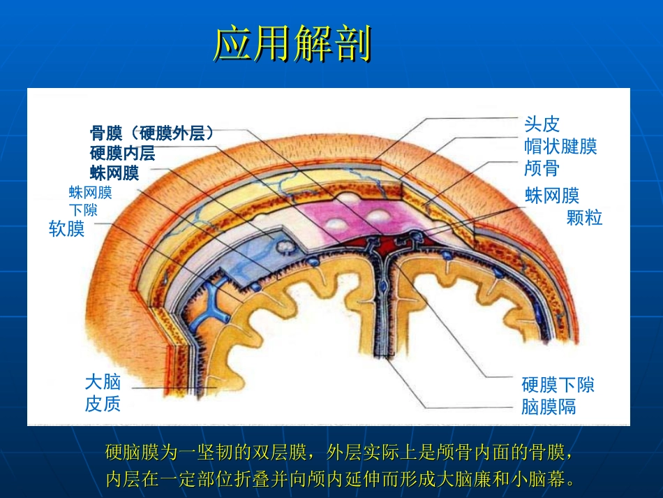小脑幕硬膜下血肿_第3页