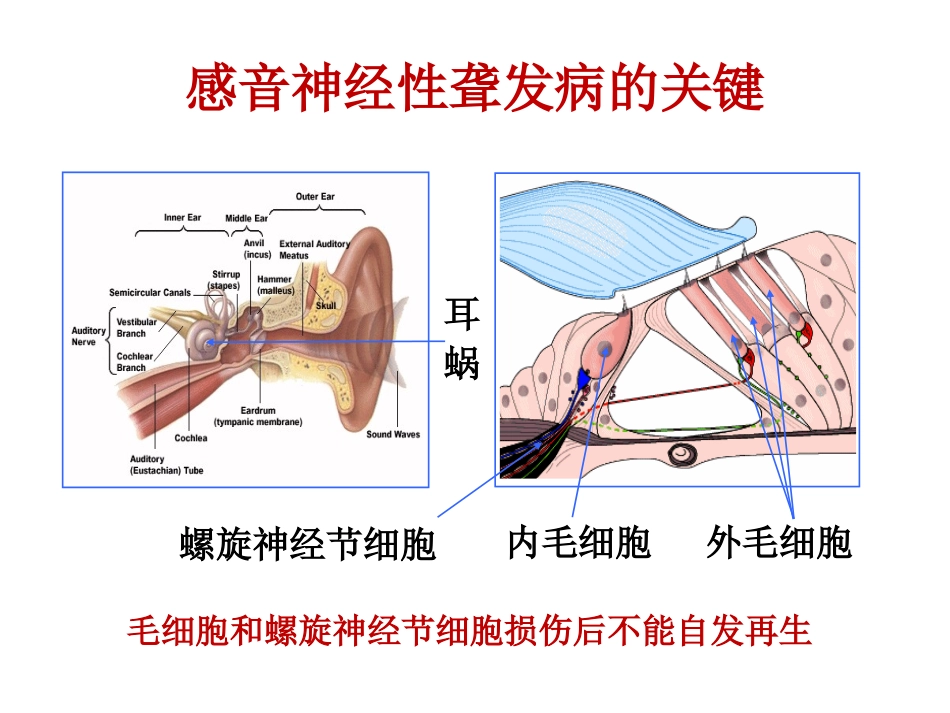 国产人工耳蜗的研制和临床验证现状_第2页