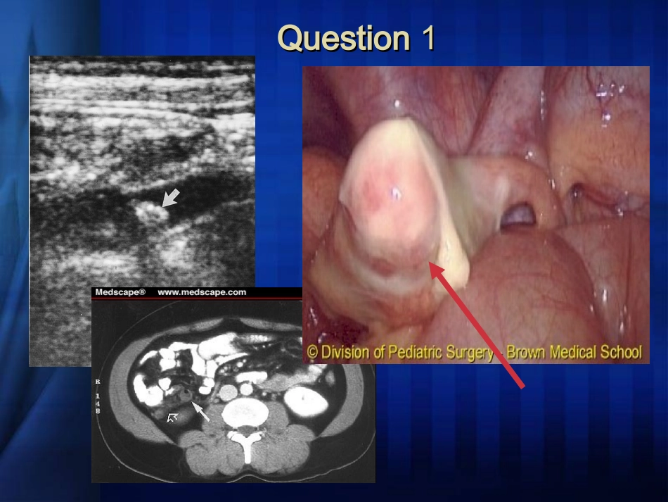 急腹症临床诊治思路_第2页