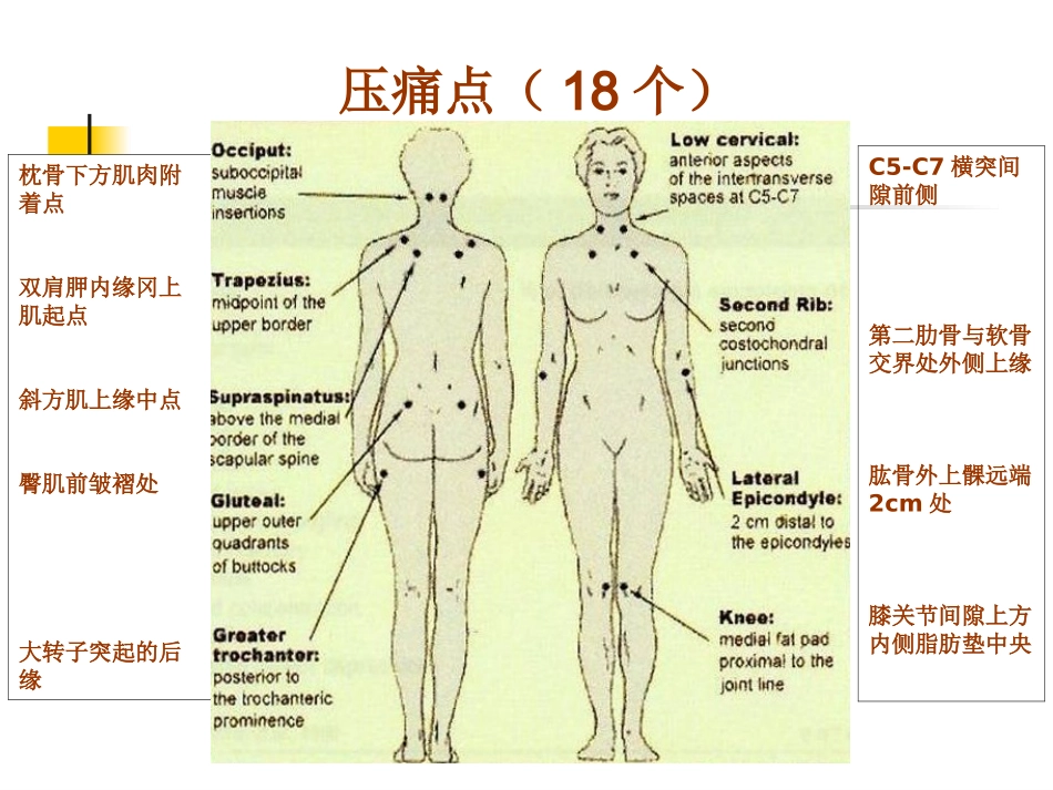 纤维肌痛综合征_第3页