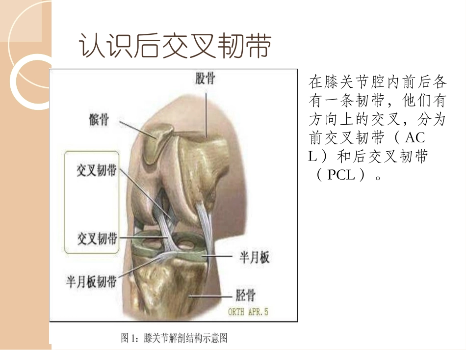 后叉韧带损伤的教学查房_第3页