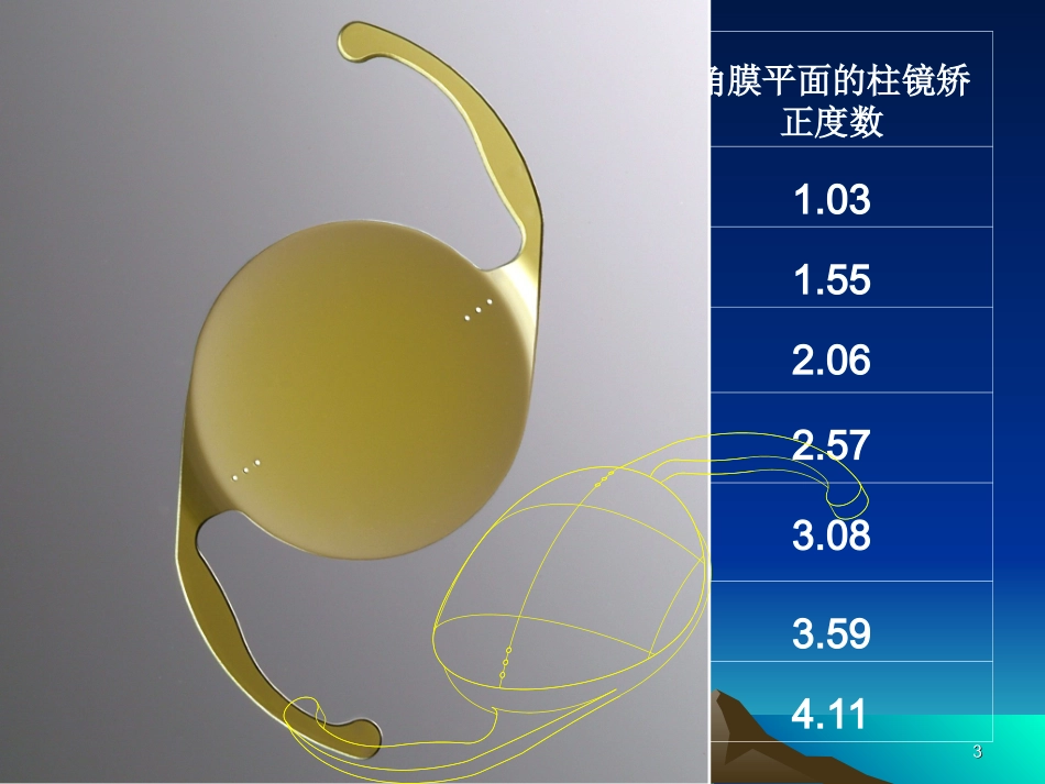 toric 术前检查_第3页