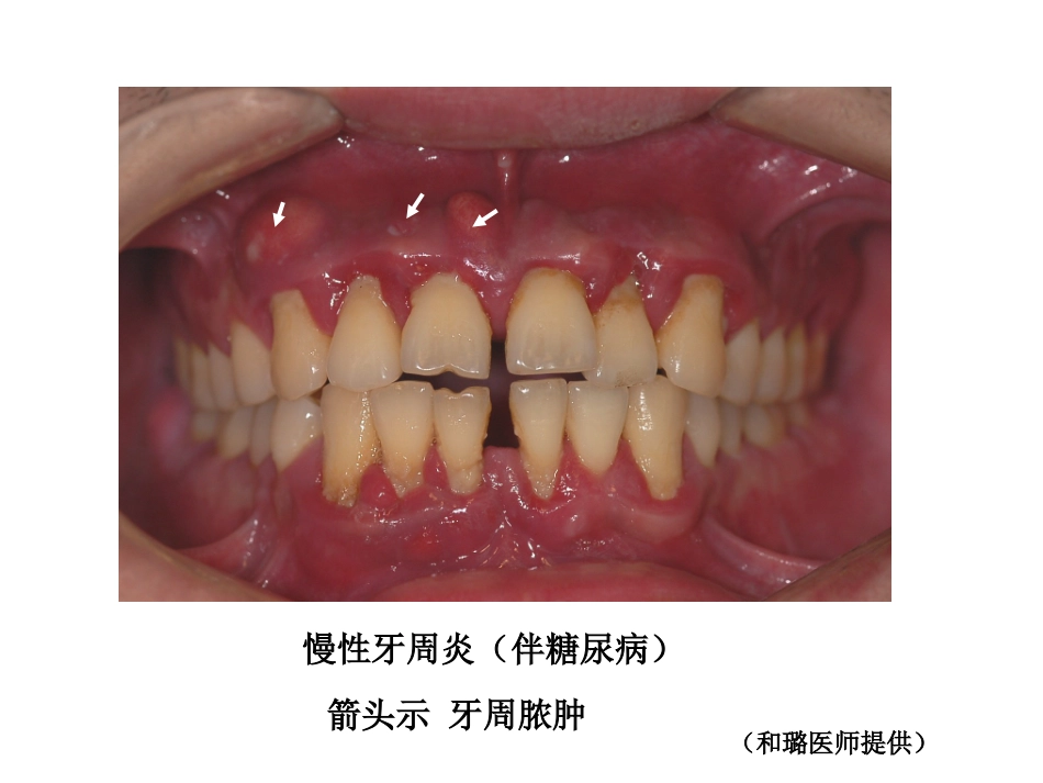 牙-周-病-学-第四版-7_第1页