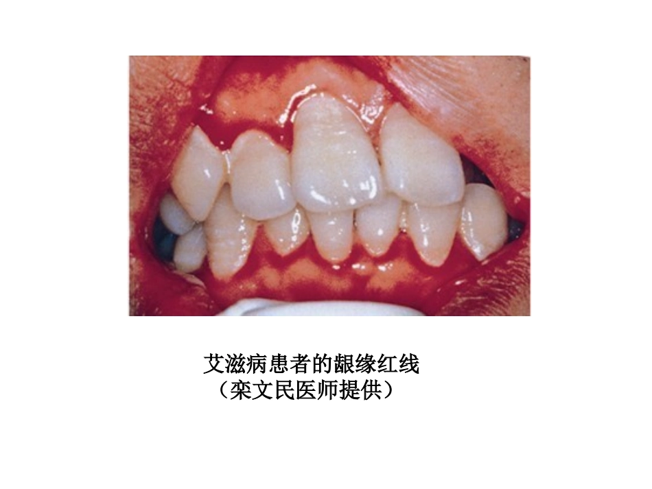 牙-周-病-学-第四版-7_第2页