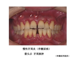 牙-周-病-学-第四版-7