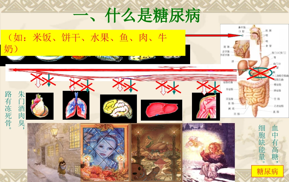 有关糖尿病知识PPT_第2页