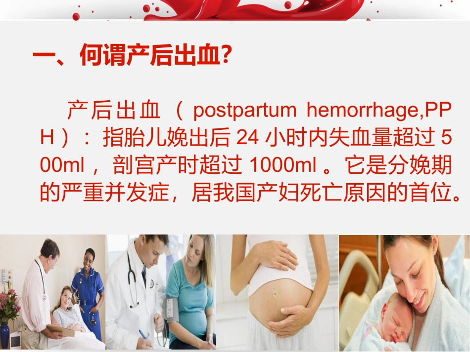 产后出血教学版_第3页