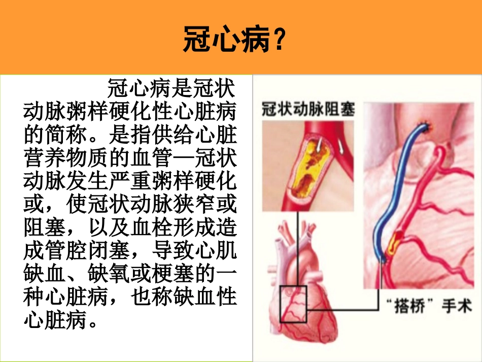 心脏搭桥的健康指导_第3页