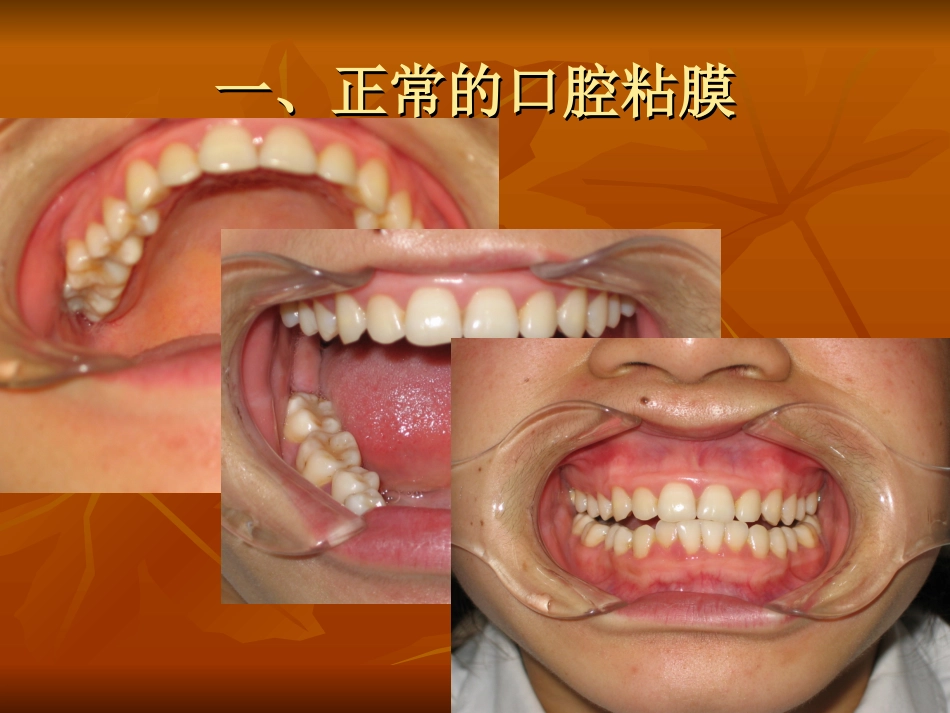 口腔冲洗规范化流程_第3页