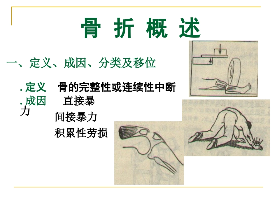 可出现前臂骨筋膜室综合征_第2页