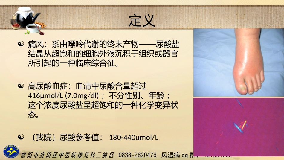 痛风性关节炎的诊治进展要点_第2页