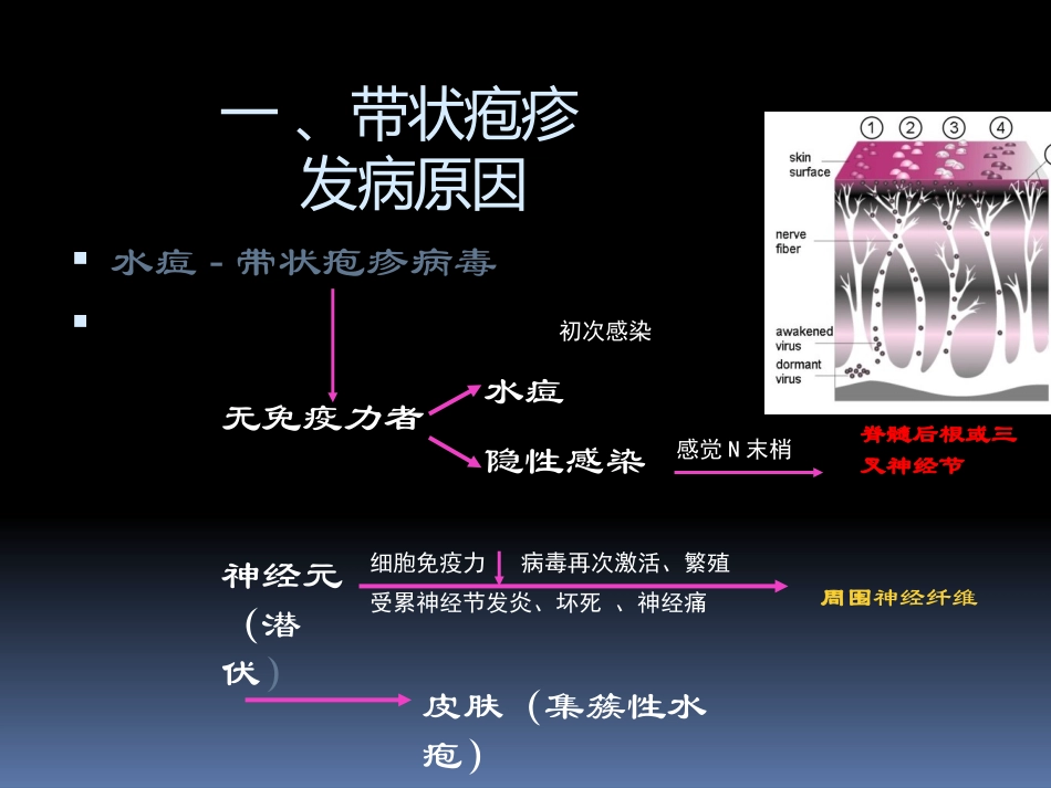 带状疱疹及后遗神经痛科普_第3页