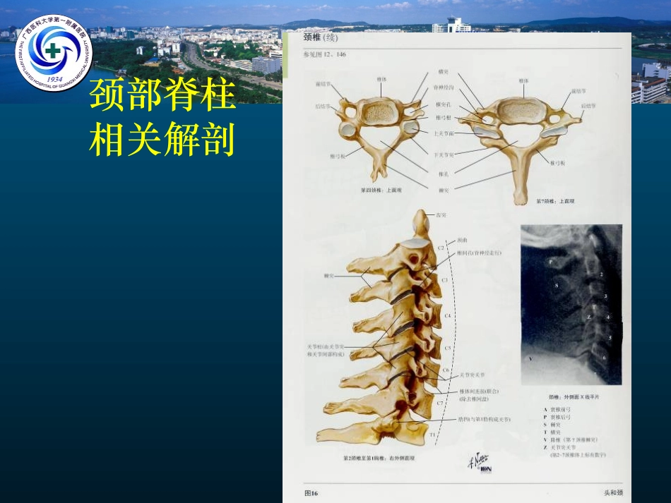 颈椎病的MRI诊断(黄仲奎)_第3页