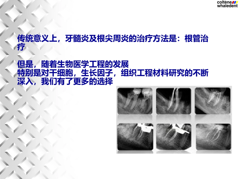 牙髓血运重建术_第2页
