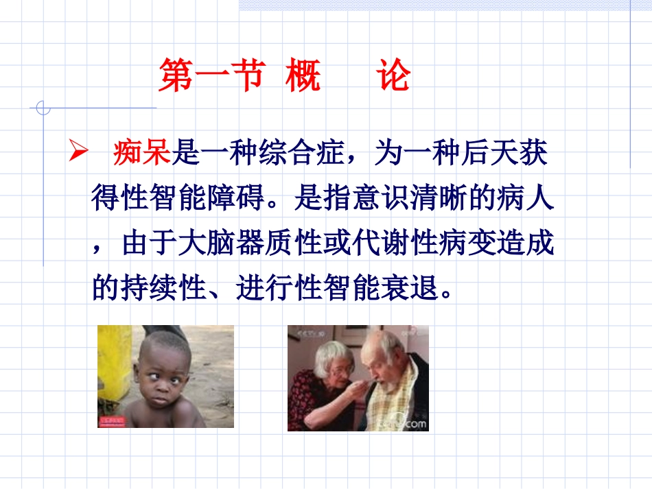 抗老年痴呆药精讲_第3页