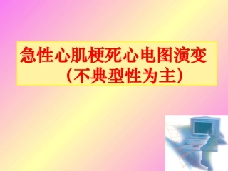 急性心肌梗死心电图演变