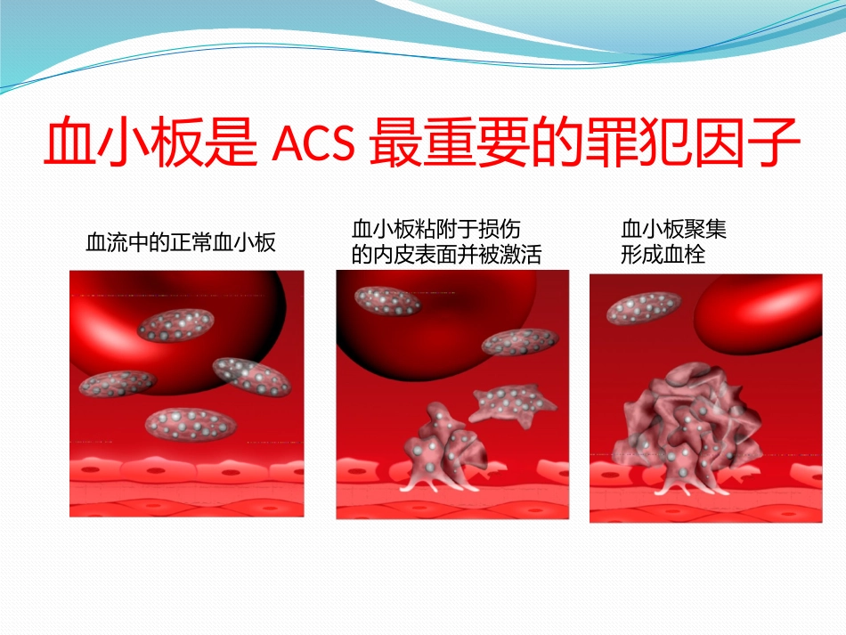 双抗消化道出血_第3页