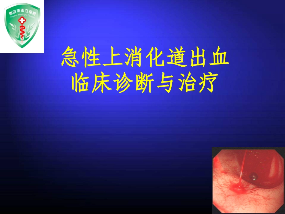 上消化道大出血的诊治_第1页