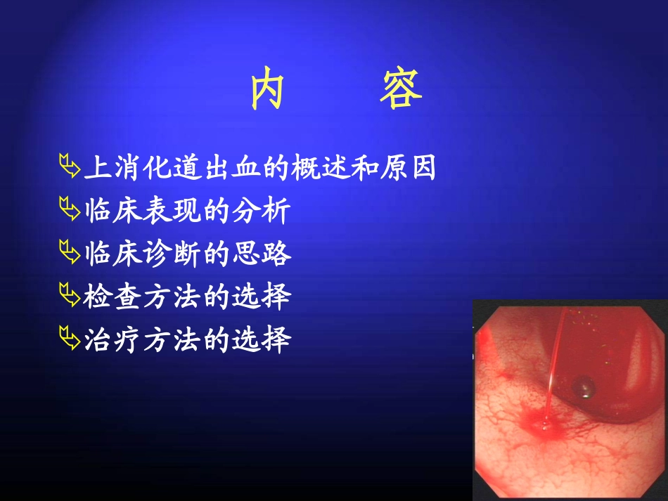 上消化道大出血的诊治_第2页