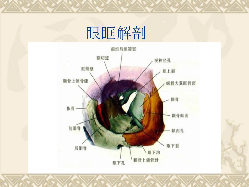 视神经鞘脑膜瘤_第2页