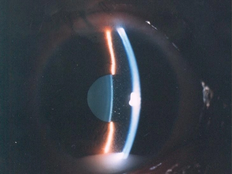 第一节 葡萄膜解剖与生理1_第3页