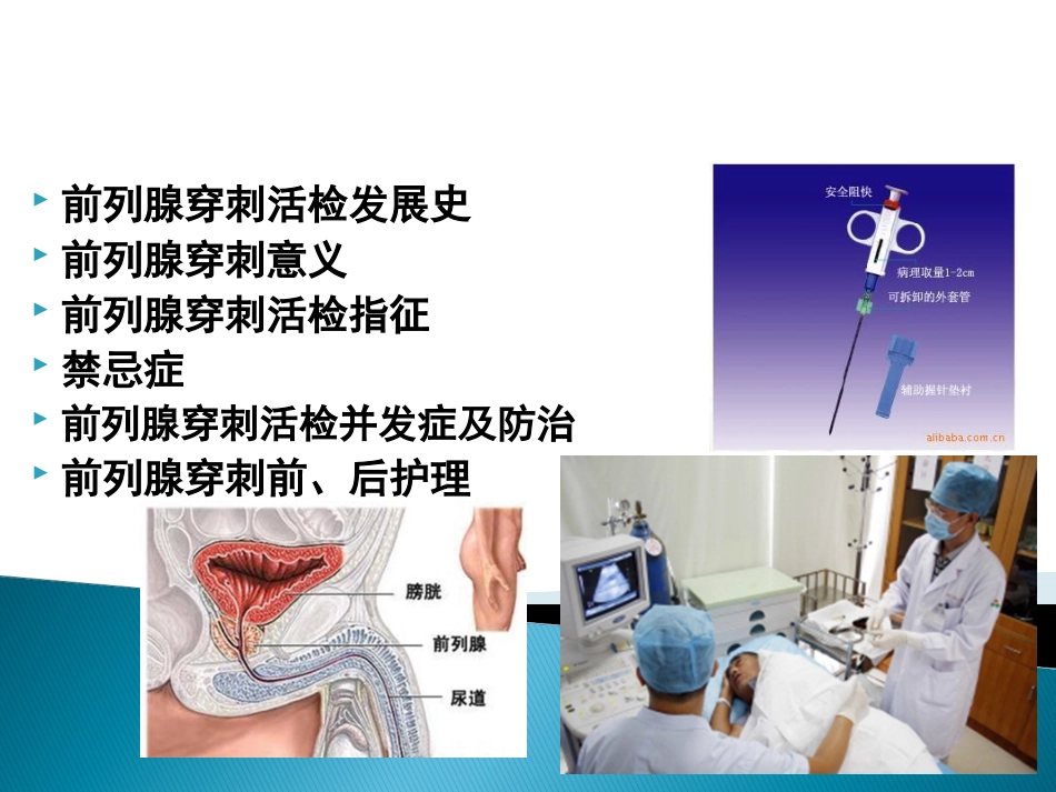 前列腺穿刺活检_第2页