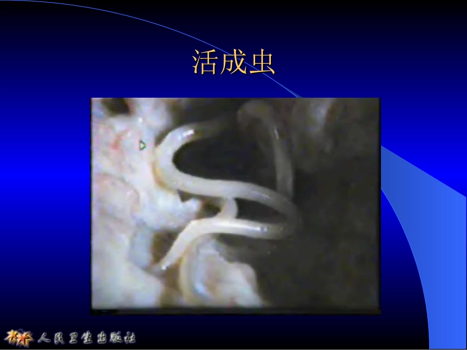 寄生虫——似蚓蛔线虫_第3页