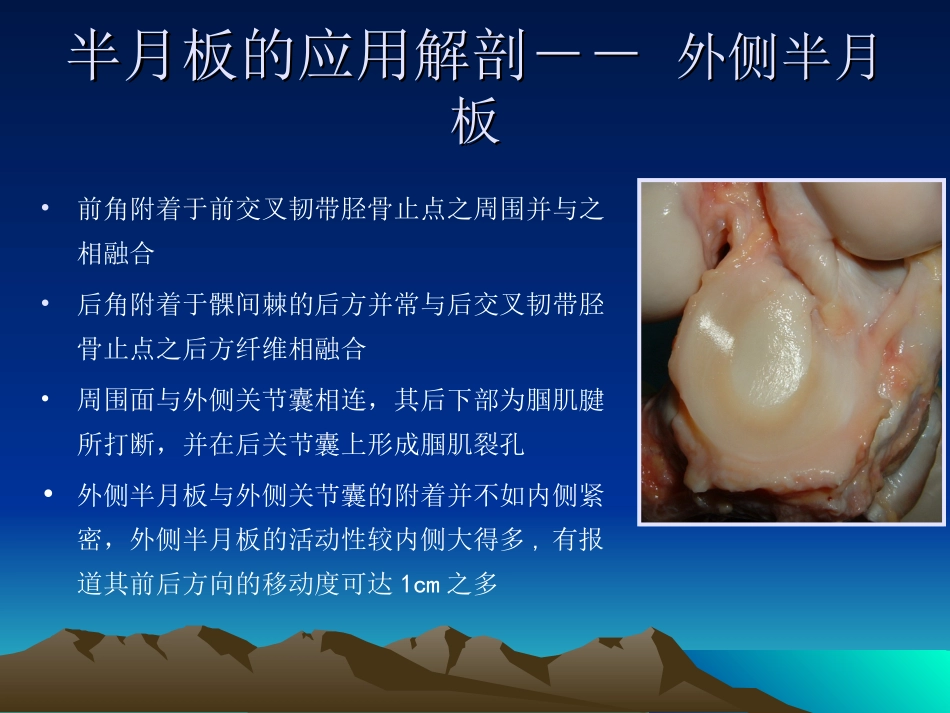 半月板解剖与MR诊断_第3页