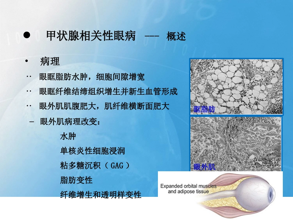 甲状腺相关性眼病影像学表现_第3页