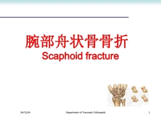 腕部舟状骨骨折