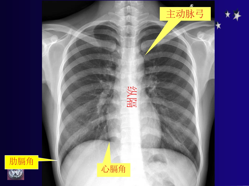 脊椎教学读片基础_第3页