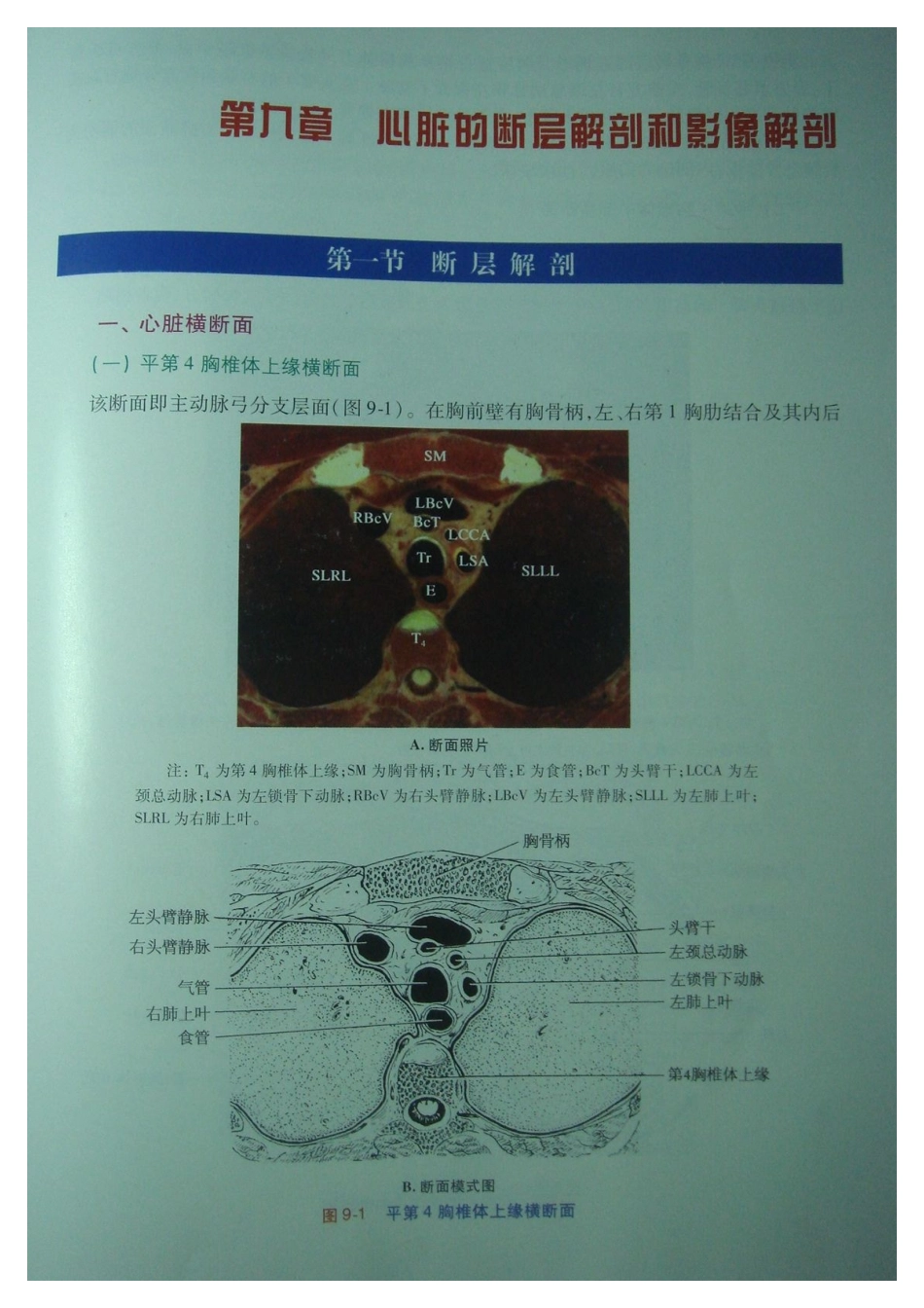 心脏的断层解剖和影像解剖_第1页