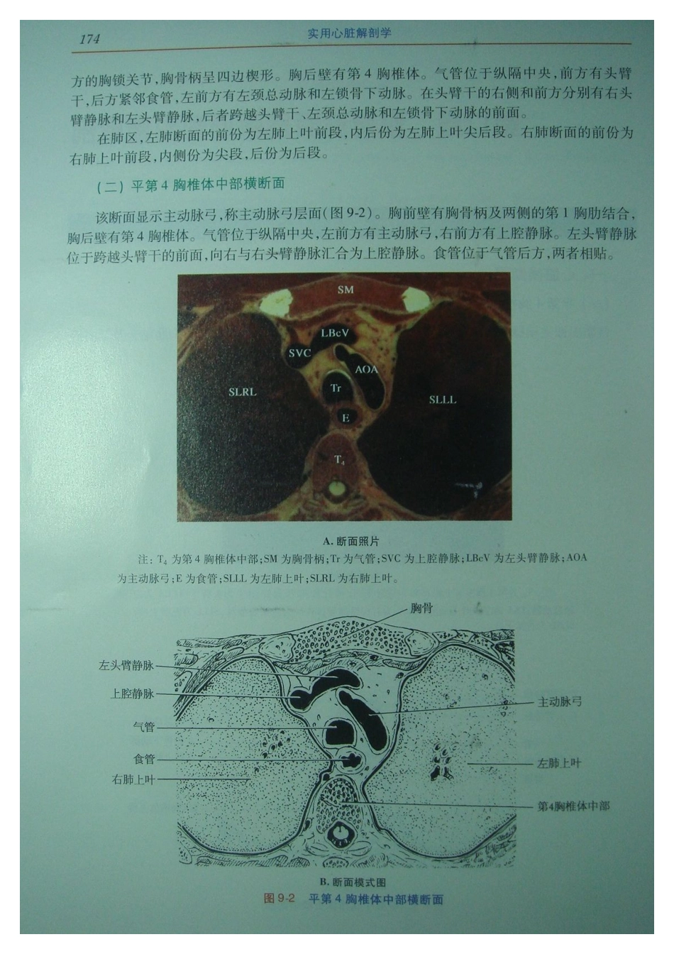 心脏的断层解剖和影像解剖_第2页